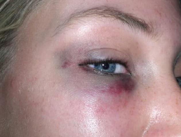 Vrouw gewond door mishandeling op Koopmansplein